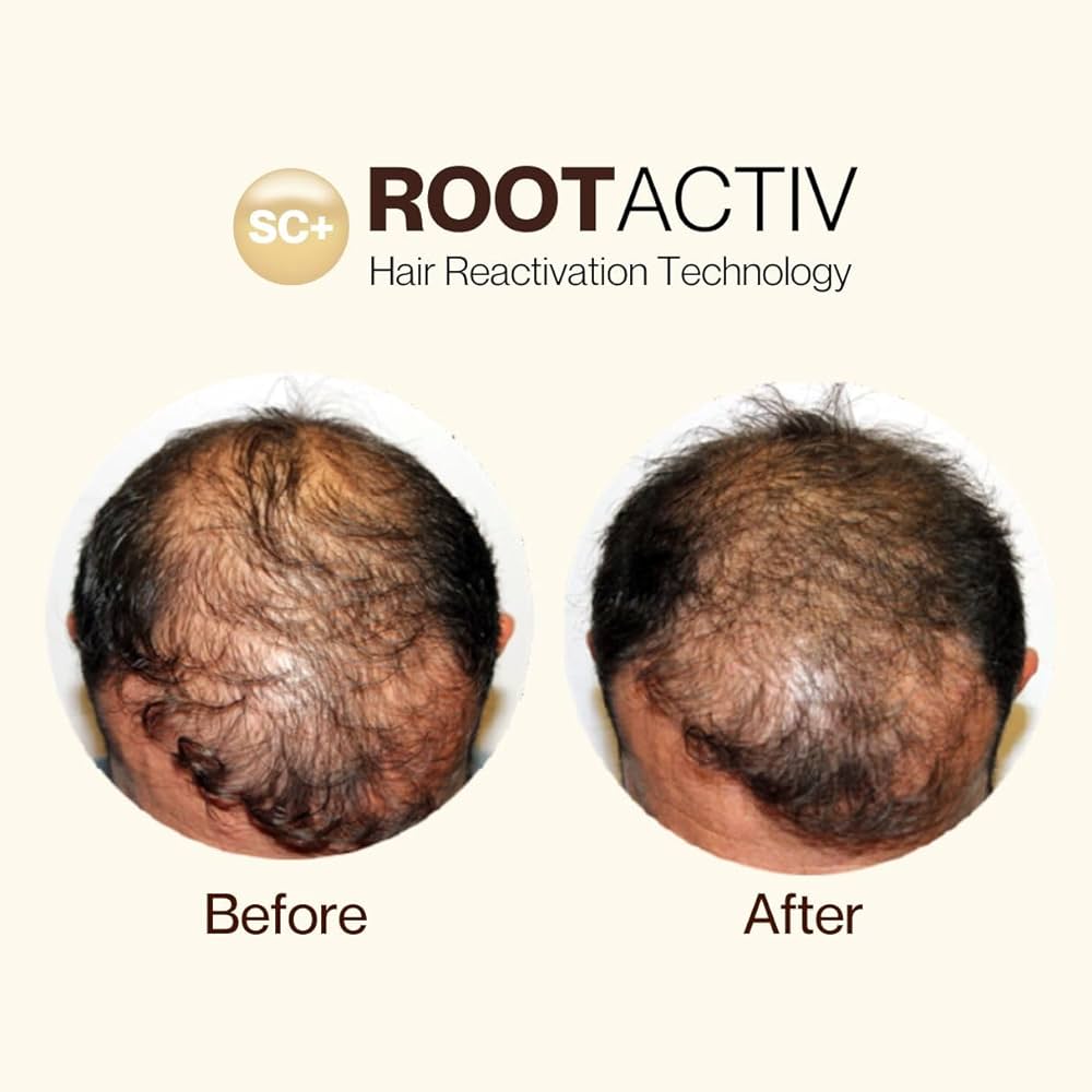 ##product## - ROOTACTIVE X3 - - Suisseteleachat