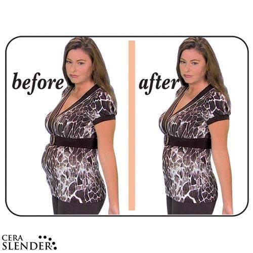 ##product## - CERA SLENDER - Vêtement amincissent - Suisseteleachat