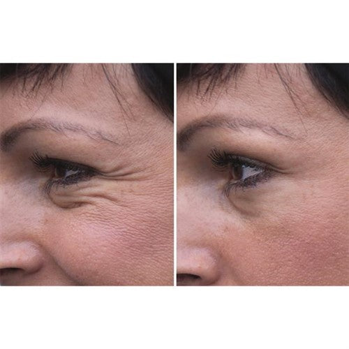 ##product## - AGE FIT - Sérum liftant - Soin visage - Suisseteleachat