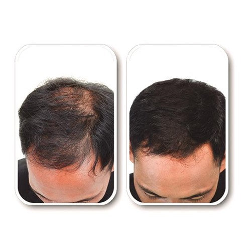 ##product## - VELFORM NUTRITIONAL X2 - Soin des cheveux - Suisseteleachat