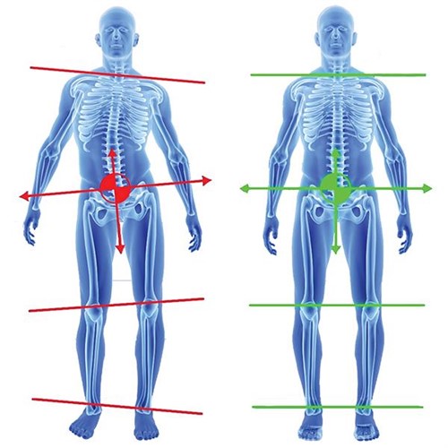 ##product## - SUPERTHOTICS - - Suisseteleachat