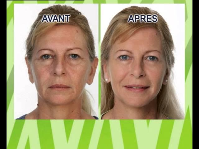 ##product## - Soin anti-âge - Jeunesse mystérieuse X2 -  - Suisseteleachat