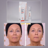 ##product## - Wrinkle power -  - Suisseteleachat