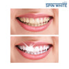 ##product## - STARLYF SPIN WHITE - Polisseur de dents - Soin du corps, Soin visage, Soin des pieds - Suisseteleachat