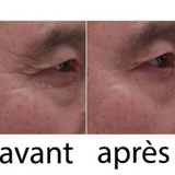 ##product## - Wrinkle power -  - Suisseteleachat