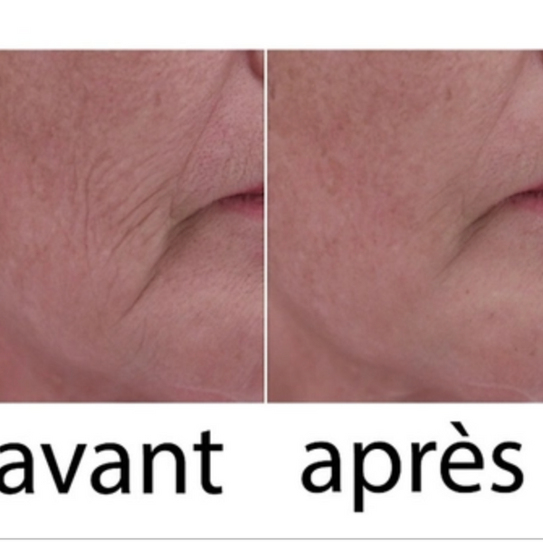 ##product## - Wrinkle power -  - Suisseteleachat