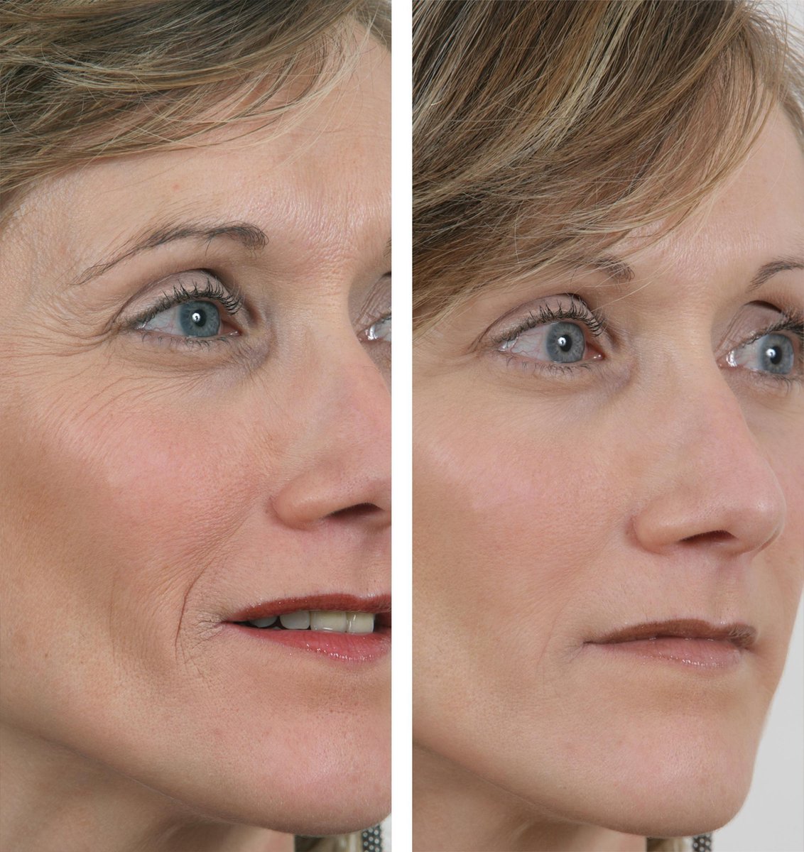 ##product## - Wrinkle power -  - Suisseteleachat