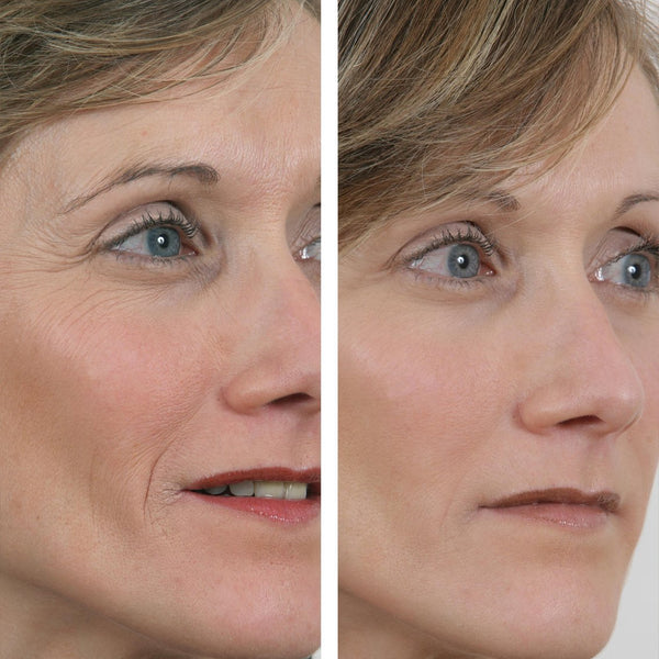 ##product## - Wrinkle power -  - Suisseteleachat