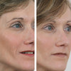 Wrinkle power X2